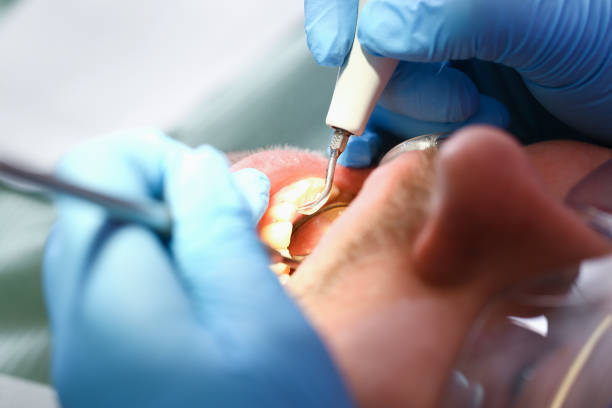 Best Knocked-Out Tooth Emergency  in Fairway, KS